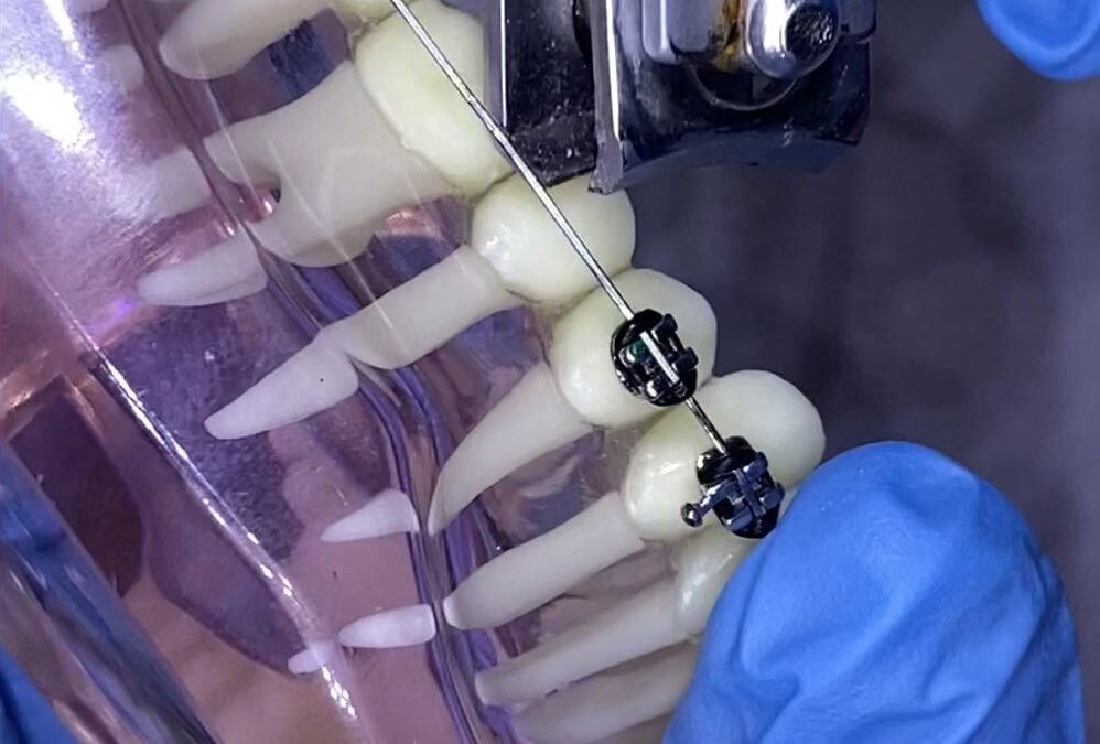 Comment couper un arc qui blesse