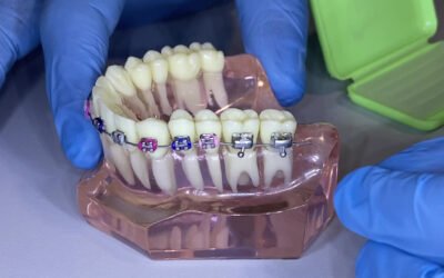 Comment mettre de la cire sur ses attaches?